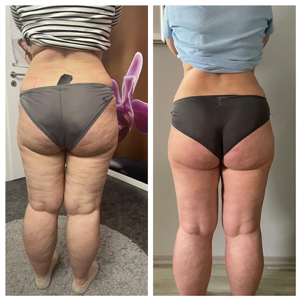 799493D3-45B3-4CFE-99B7-F17A8A146F9D